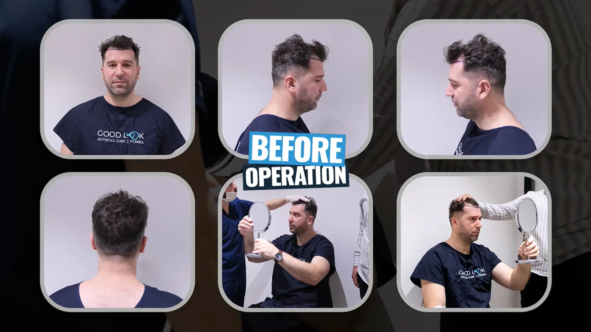 Pre-operative preparation before surgery